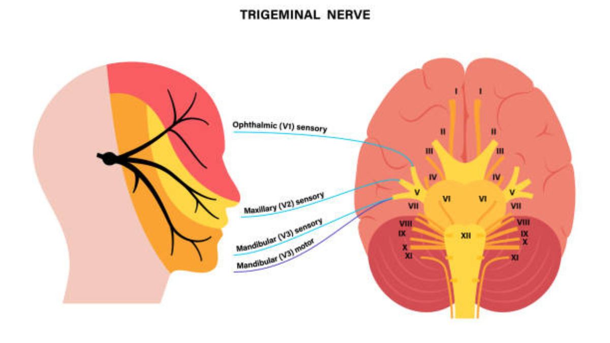 What can be Mistaken for Trigeminal Neuralgia